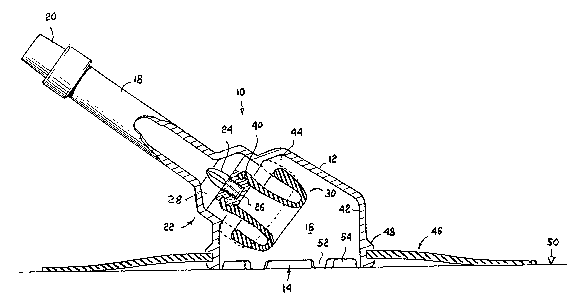 A single figure which represents the drawing illustrating the invention.